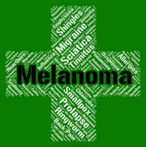skin cancer | Melanoma