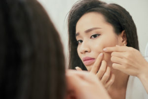 Why Picking Pimples is a Big No-No | Acne Treatment New York City, NY
