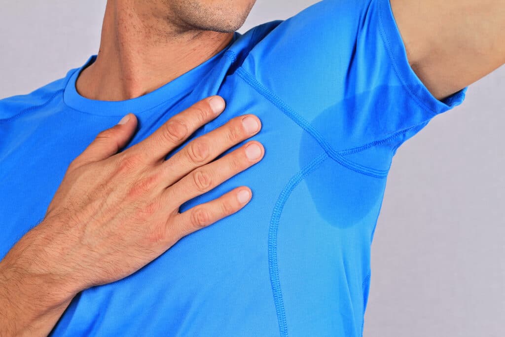 Hyperhidrosis NYC | Excessive Sweating Treatment Hyperhidrosis NYC | Excessive Sweating Treatment