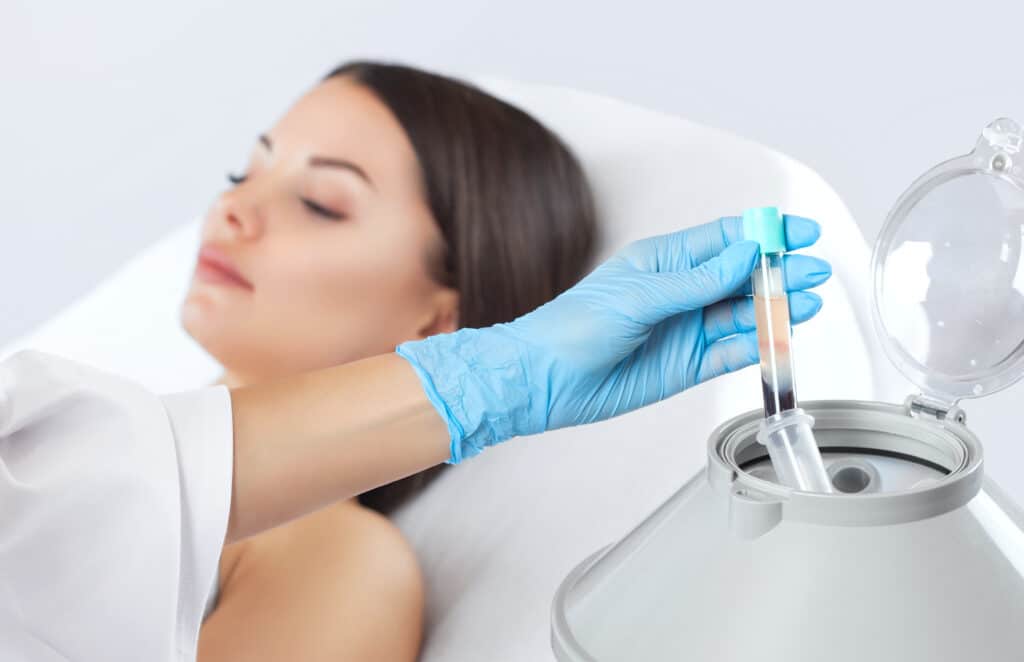 PRP Injections NYC